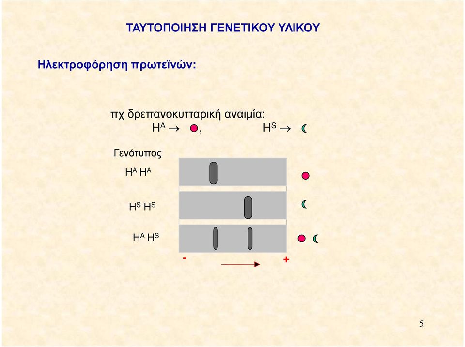 δρεπανοκυτταρική αναιµία: Η Α, Η