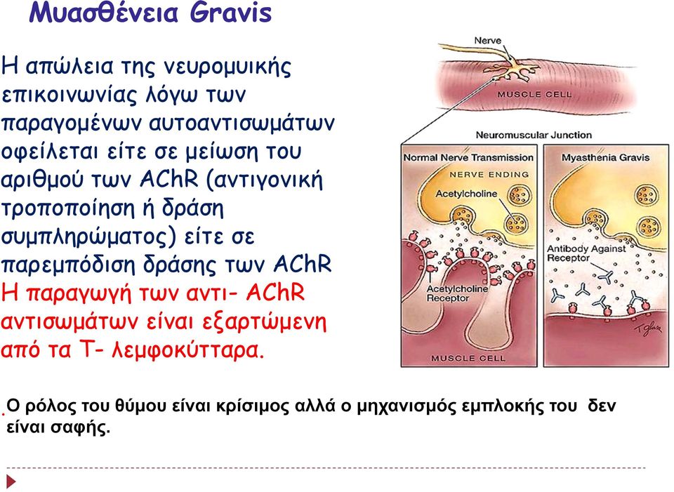 είτε σε παρεμπόδιση δράσης των AChR Η παραγωγή των αντι- AChR αντισωμάτων είναι εξαρτώμενη από