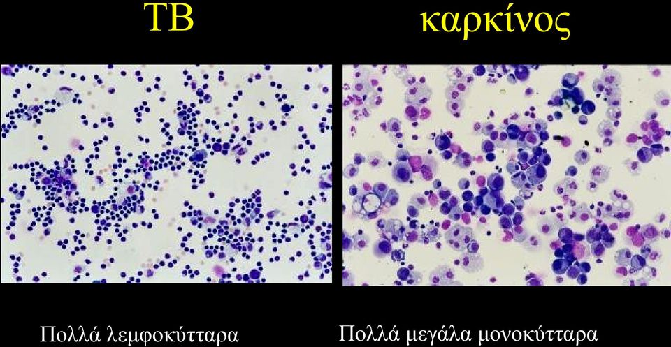 ιεκθνθχηηαξα 