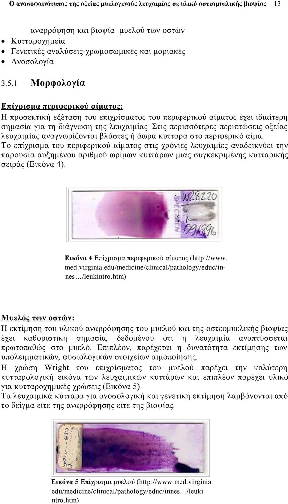 Στις περισσότερες περιπτώσεις οξείας λευχαιμίας αναγνωρίζονται βλάστες ή άωρα κύτταρα στο περιφερικό αίμα.