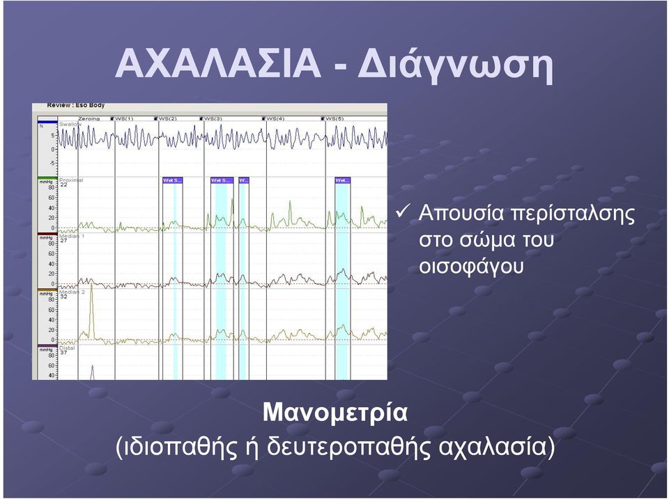 οισοφάγου Μανομετρία