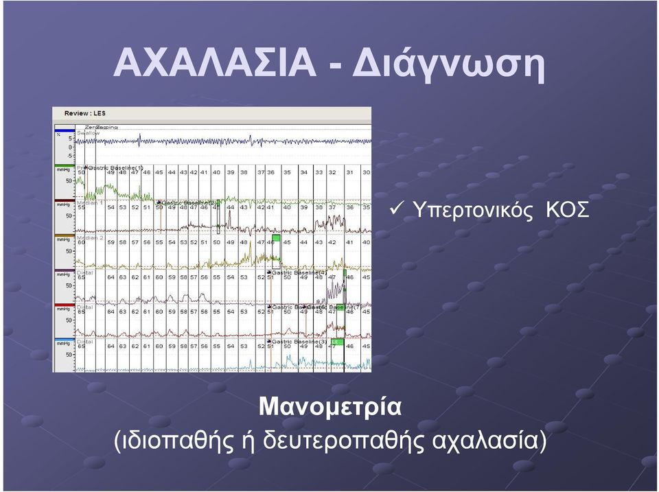 Μανομετρία