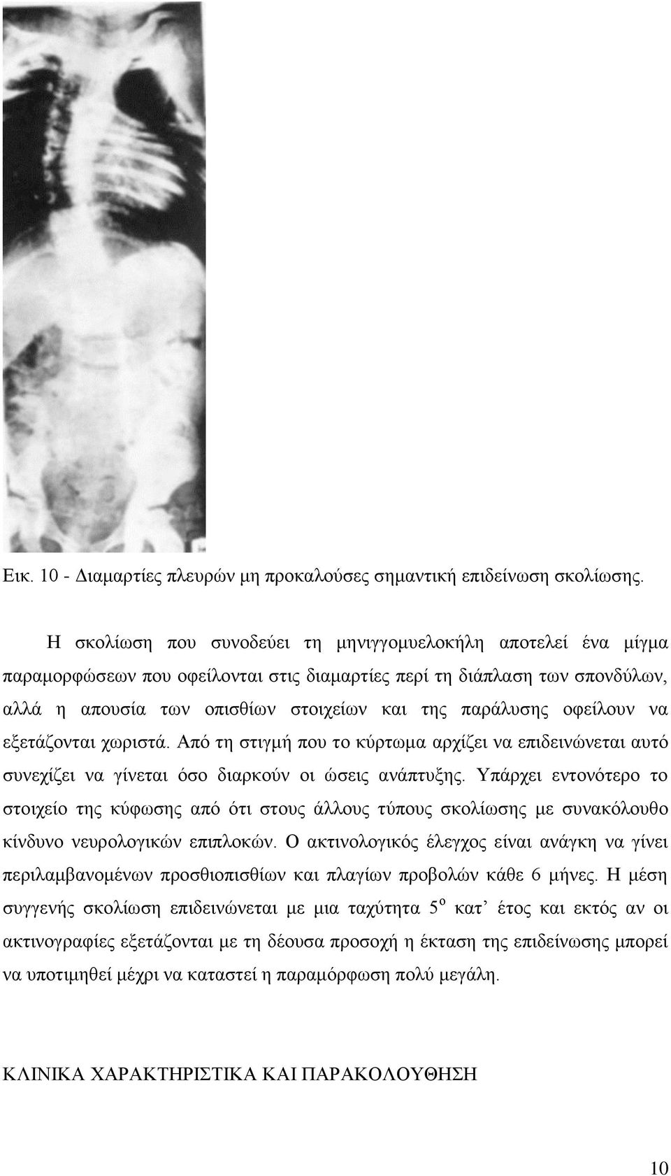 οφείλουν να εξετάζονται χωριστά. Από τη στιγμή που το κύρτωμα αρχίζει να επιδεινώνεται αυτό συνεχίζει να γίνεται όσο διαρκούν οι ώσεις ανάπτυξης.