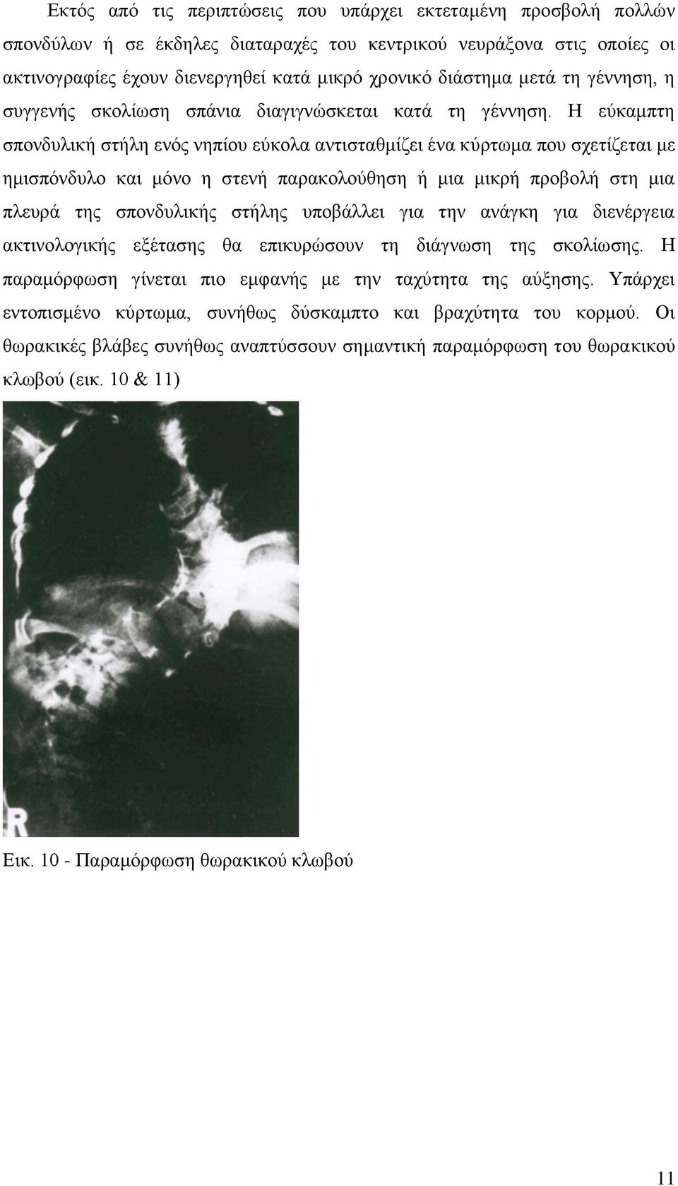 Η εύκαμπτη σπονδυλική στήλη ενός νηπίου εύκολα αντισταθμίζει ένα κύρτωμα που σχετίζεται με ημισπόνδυλο και μόνο η στενή παρακολούθηση ή μια μικρή προβολή στη μια πλευρά της σπονδυλικής στήλης