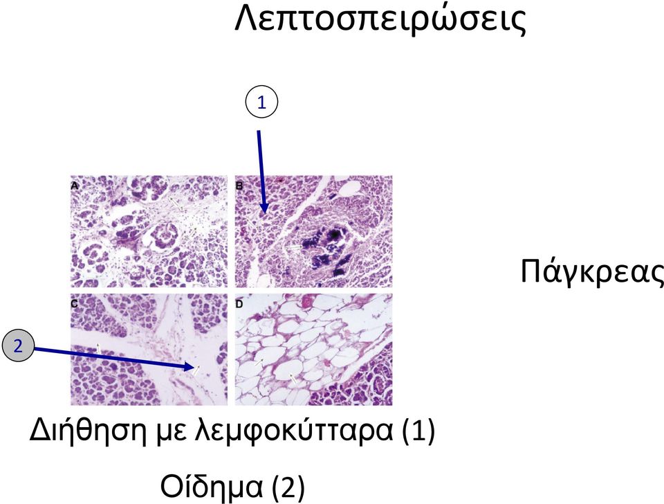 Διήθηση με