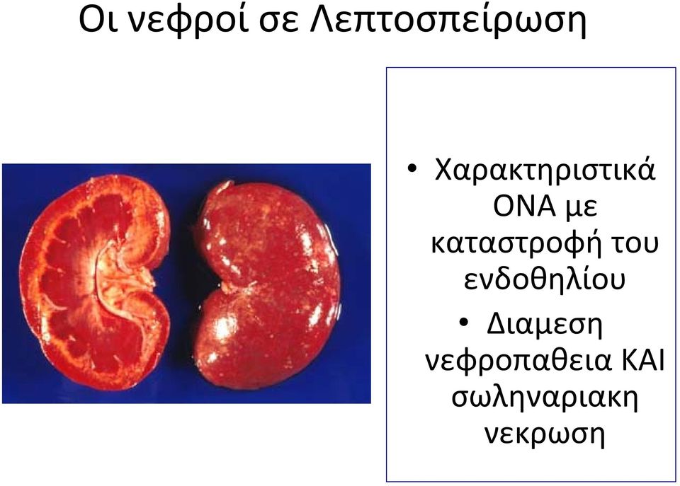 καταστροφή του ενδοθηλίου