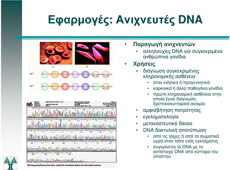 στην οποία έγινε διάγνωση: δρεπανοκυτταρική αναιµία αµφισβήτηση πατρότητας εγκληµατολογία µεταναστευτικό δίκαιο DNA δακτυλική