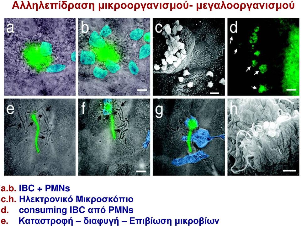 Ηλεκτρονικό Μικροσκόπιο d.