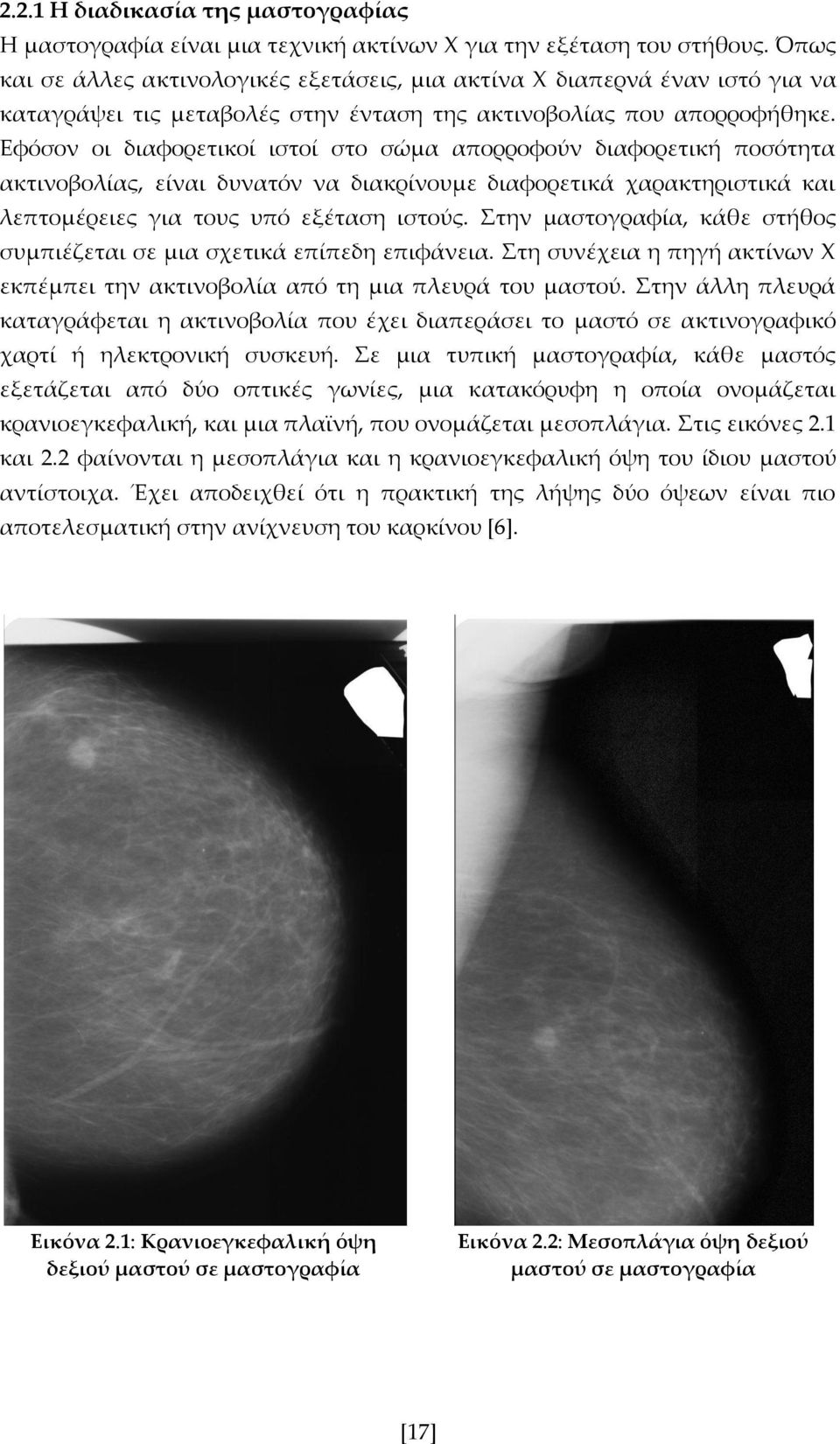 Εφόσον οι διαφορετικοί ιστοί στο σώμα απορροφούν διαφορετική ποσότητα ακτινοβολίας, είναι δυνατόν να διακρίνουμε διαφορετικά χαρακτηριστικά και λεπτομέρειες για τους υπό εξέταση ιστούς.