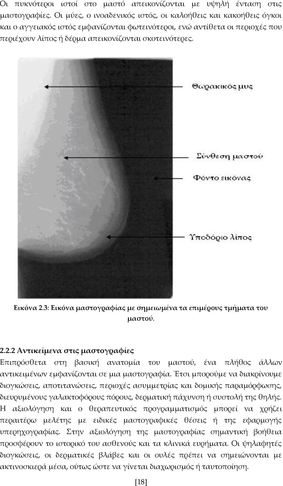 Εικόνα 2.3: Εικόνα μαστογραφίας με σημειωμένα τα επιμέρους τμήματα του μαστού. 2.2.2 Αντικείμενα στις μαστογραφίες Επιπρόσθετα στη βασική ανατομία του μαστού, ένα πλήθος άλλων αντικειμένων εμφανίζονται σε μια μαστογραφία.