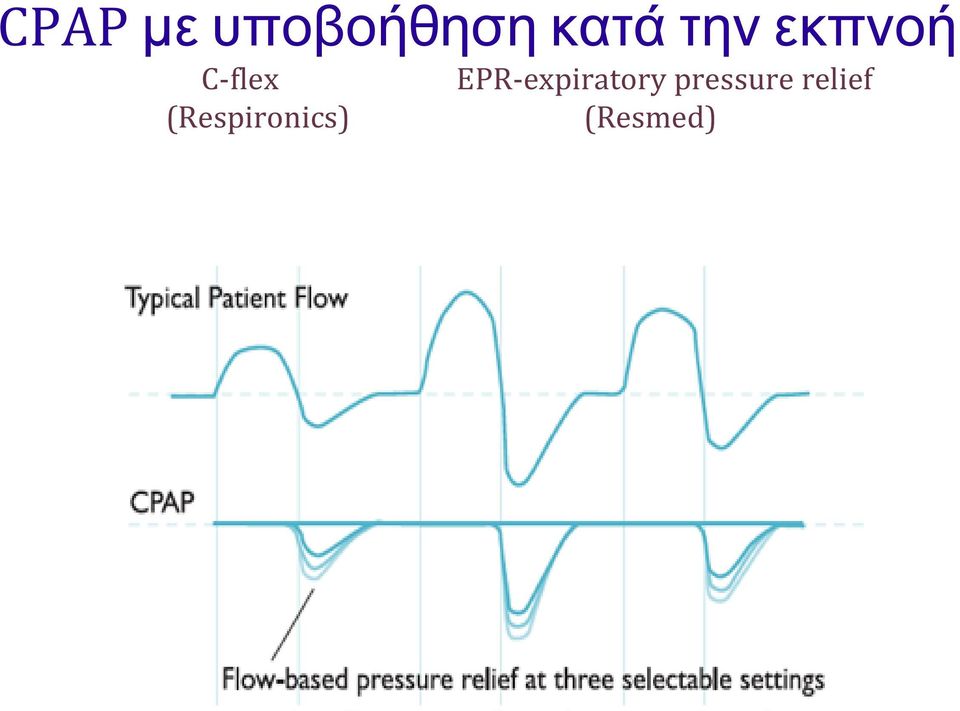EPR-expiratory pressure