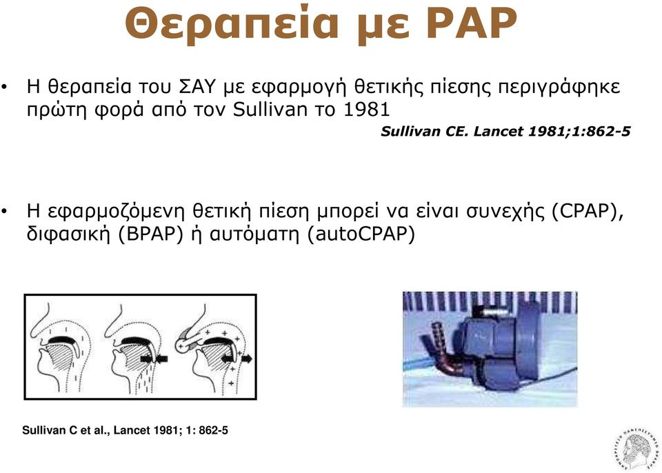 Lancet 1981;1:862-5 Η εφαρµοζόµενη θετική πίεση µπορεί να είναι