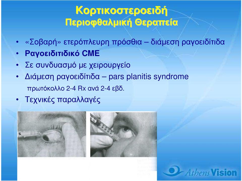 CME Σε συνδυασµό µε χειρουργείο ιάµεση ραγοειδίτιδα pars