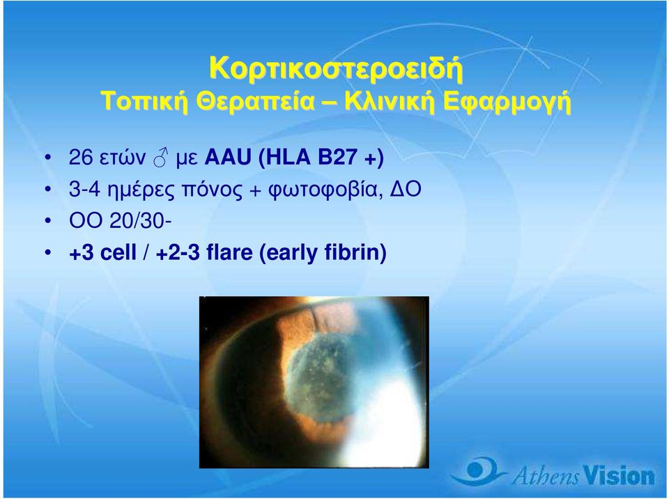 B27 +) 3-4 ηµέρες πόνος + φωτοφοβία, Ο