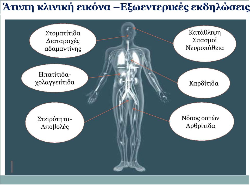 Σπαζκνί Νεπξνπάζεηα Καξδίηηδα