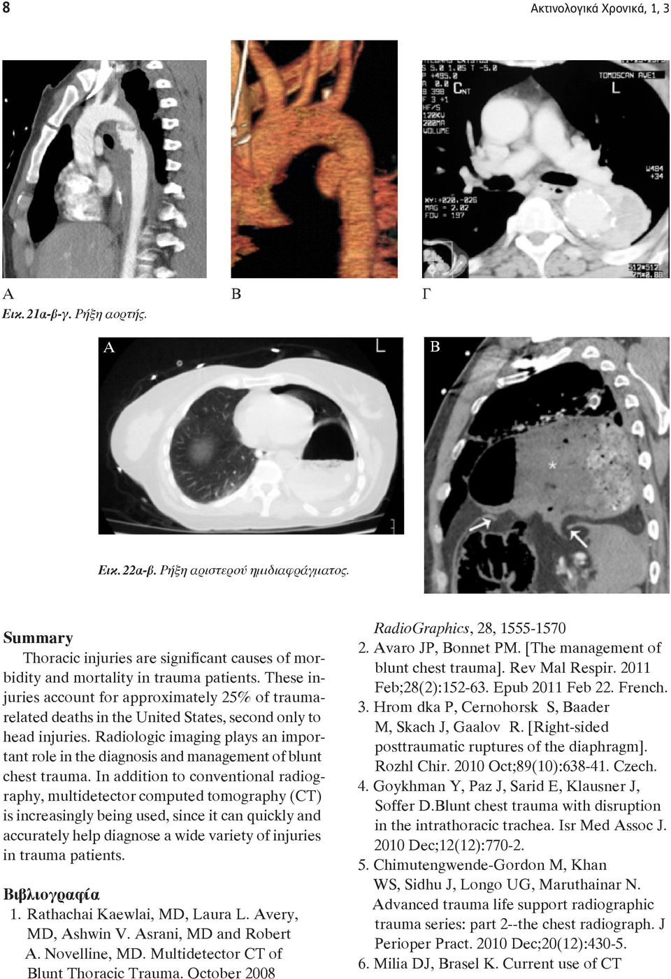 Radiologic imaging plays an important role in the diagnosis and management of blunt chest trauma.