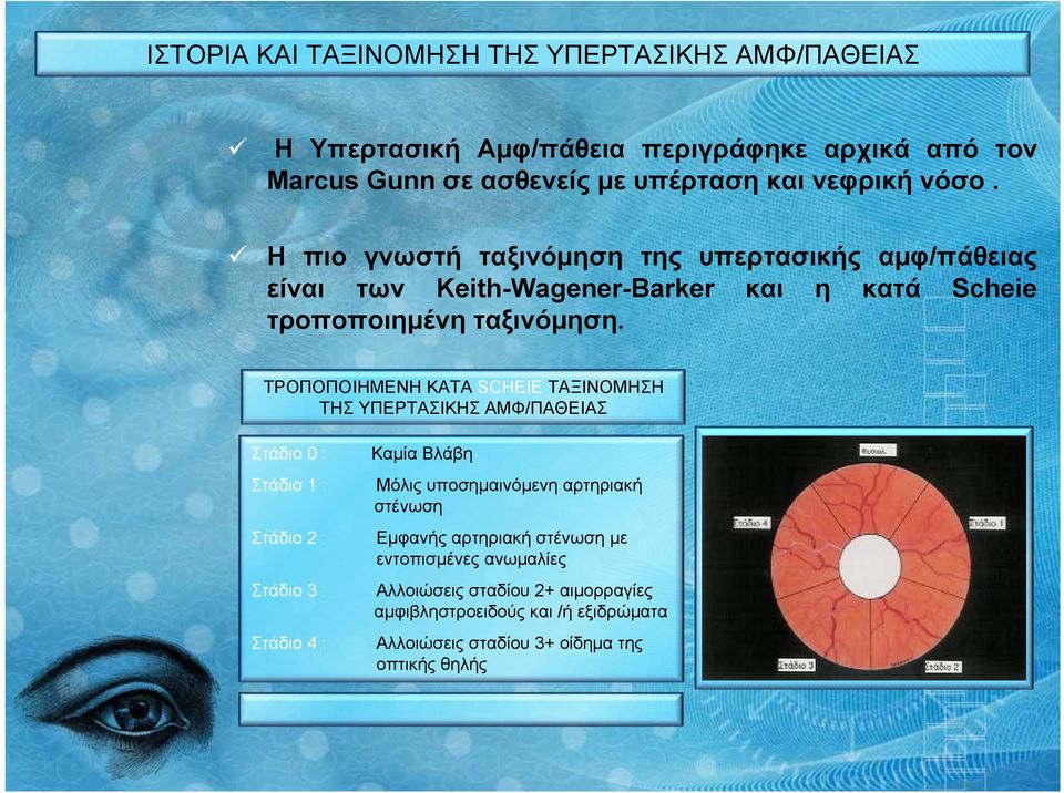 ΤΡΟΠΟΠΟΙΗΜΕΝΗ ΚΑΤΑ SCHEIE ΤΑΞΙΝΟΜΗΣΗ ΤΗΣ ΥΠΕΡΤΑΣΙΚΗΣ ΑΜΦ/ΠΑΘΕΙΑΣ Στάδιο 0 : Καμία Βλάβη Στάδιο 1 : Στάδιο 2 : Στάδιο 3 : Στάδιο 4 : Μόλις υποσημαινόμενη