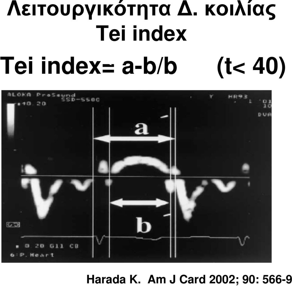 index= a-b/b (t< 40) W