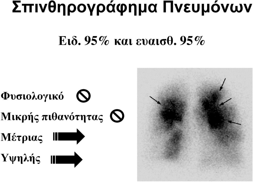 95% και ευαισθ.