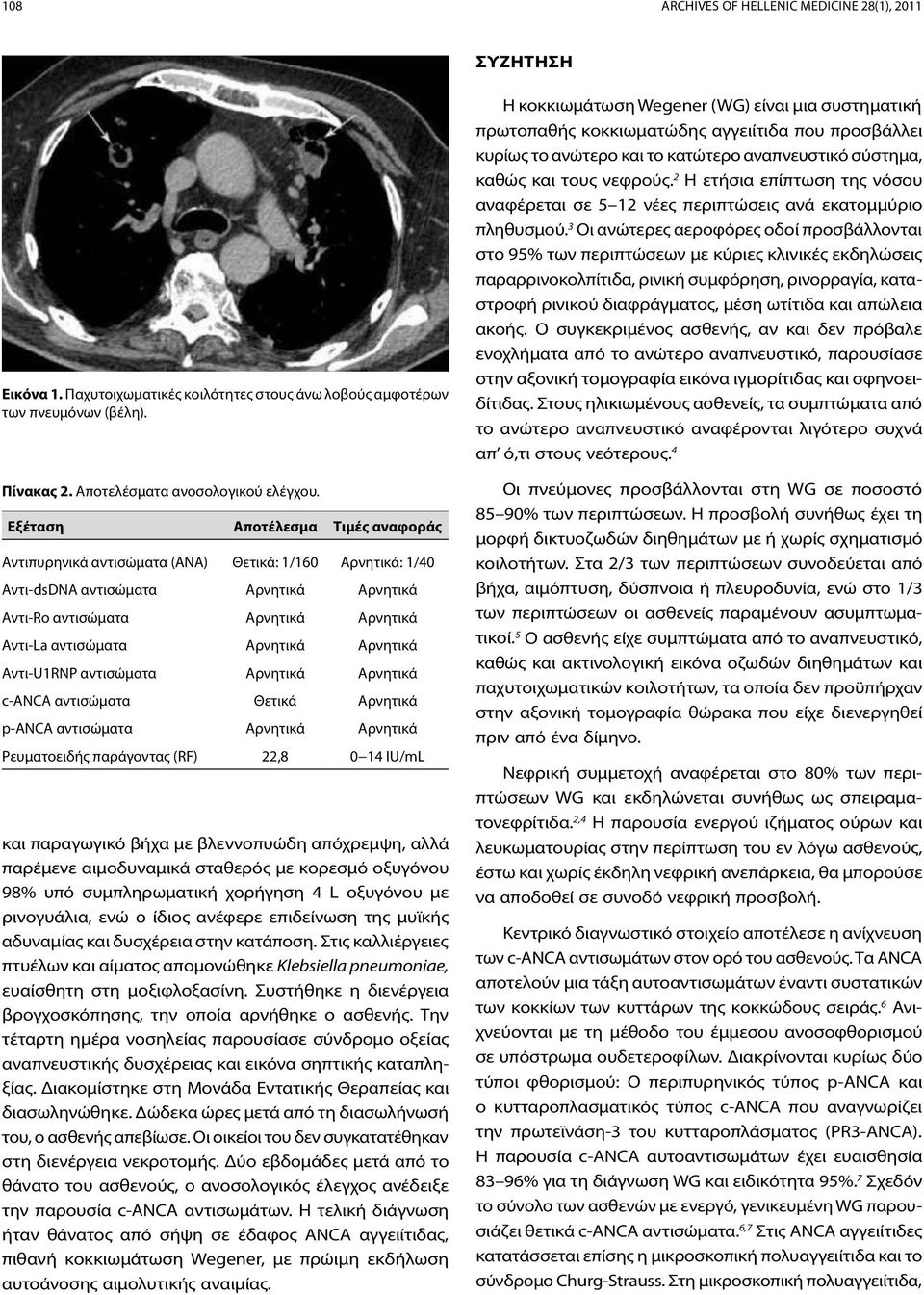 Αρνητικά Αντι-U1RNP αντισώματα Αρνητικά Αρνητικά c-anca αντισώματα Θετικά Αρνητικά p-anca αντισώματα Αρνητικά Αρνητικά Ρευματοειδής παράγοντας (RF) 22,8 0 14 IU/mL και παραγωγικό βήχα με βλεννοπυώδη