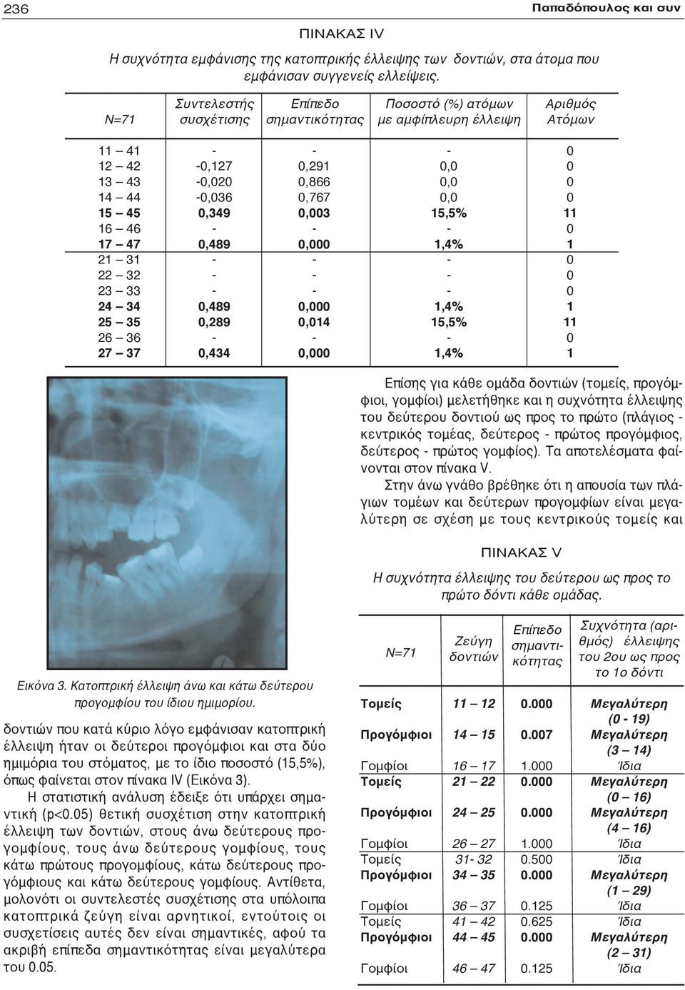 5,5%,4%,4% 5,5%,4% Επίσης για κάθε ομάδα δοντιών (τομείς, προγόμφιοι, γομφίοι) μελετήθηκε και η συχνότητα έλλειψης του δεύτερου δοντιού ως προς το πρώτο (πλάγιος κεντρικός τομέας, δεύτερος πρώτος