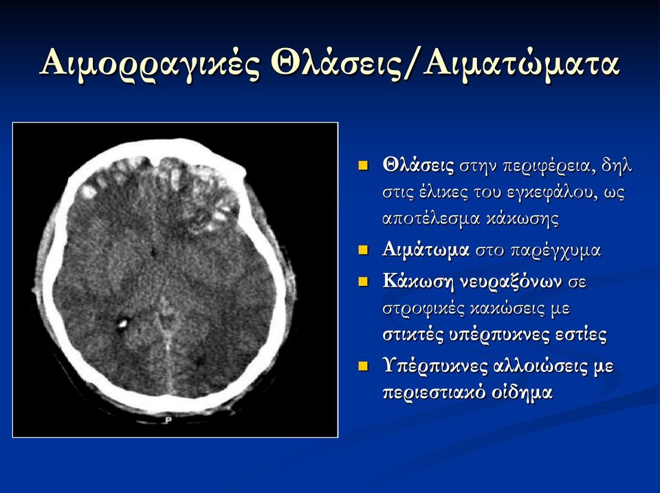 παρέγχυμα Κάκωση νευραξόνων σε στροφικές κακώσεις με στικτές