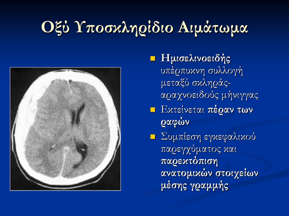 Εκτείνεται πέραν των ραφών Συμπίεση εγκεφαλικού