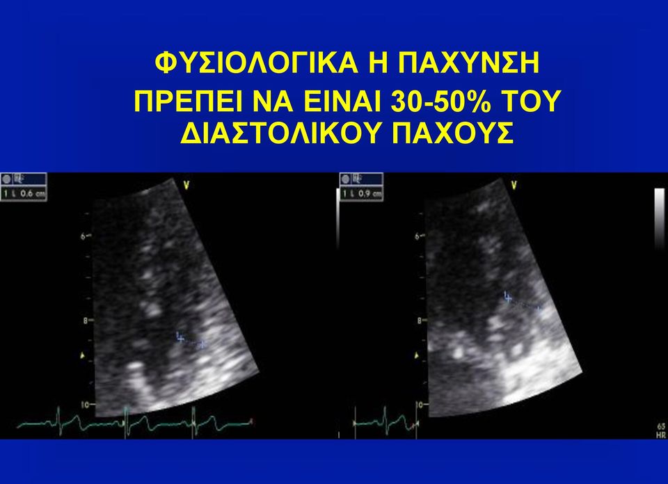 ΝΑ ΕΙΝΑΙ 30-50%