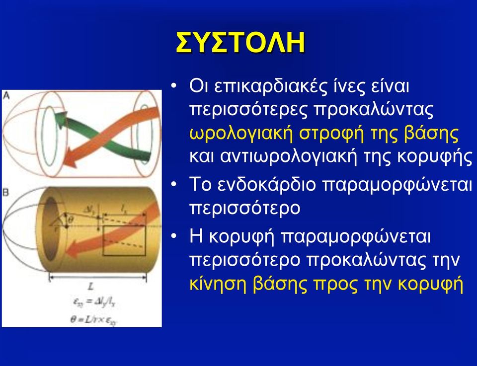 Το ενδοκάρδιο παραµορφώνεται περισσότερο Η κορυφή