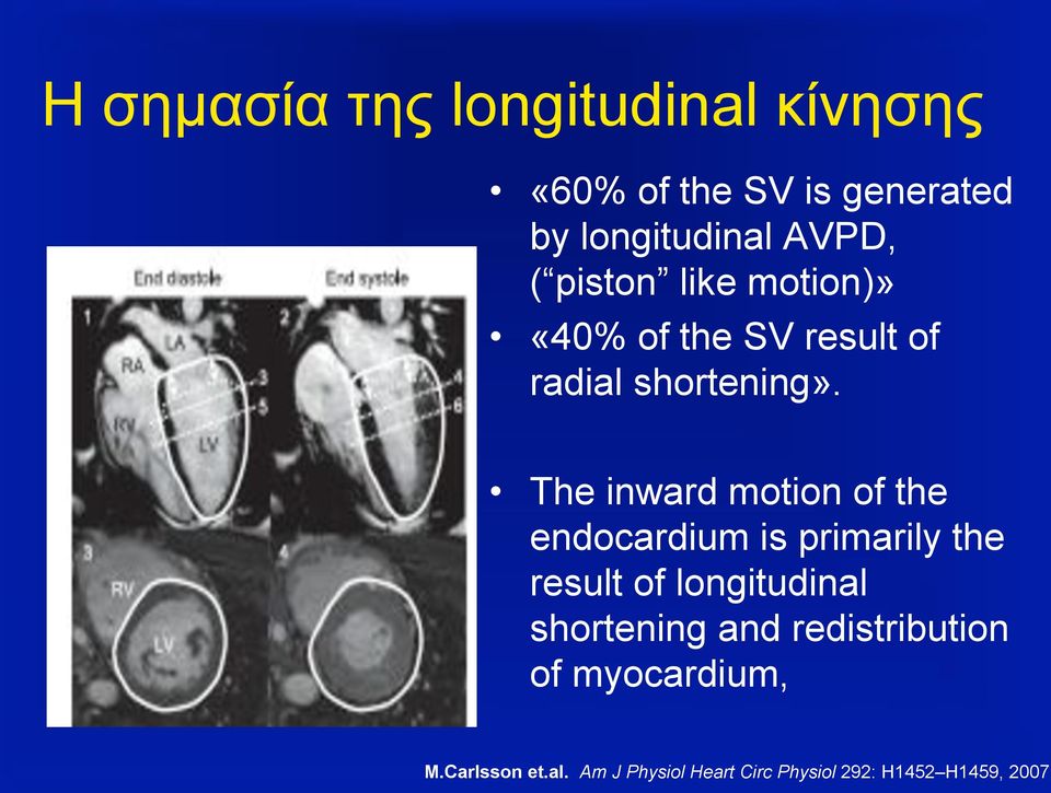 The inward motion of the endocardium is primarily the result of longitudinal