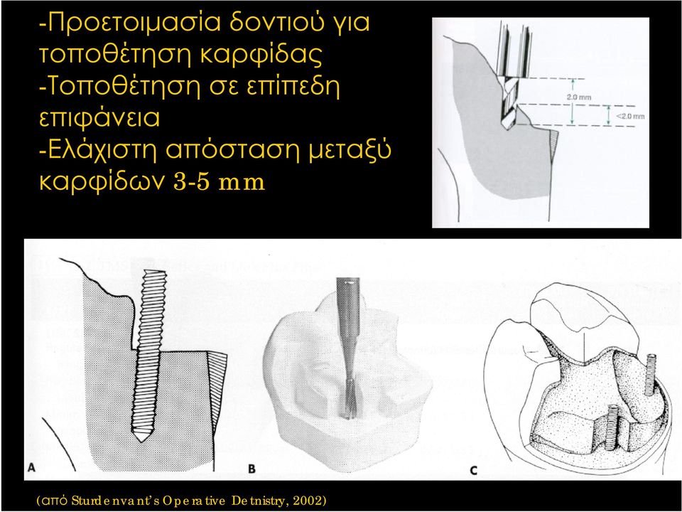 -Ελάχιστη απόσταση μεταξύ καρφίδων 3-5 mm