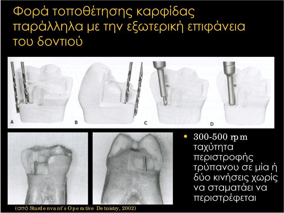 Detnistry, 2002) 300-500 rpm ταχύτητα περιστροφής