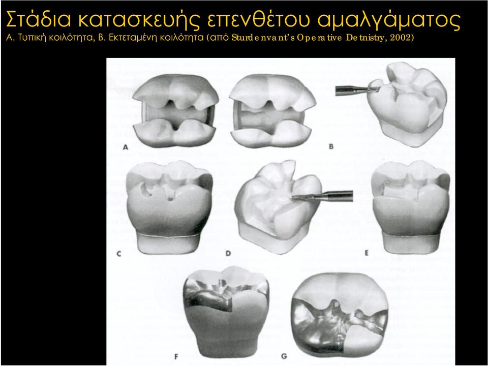 Τυπική κοιλότητα, Β.