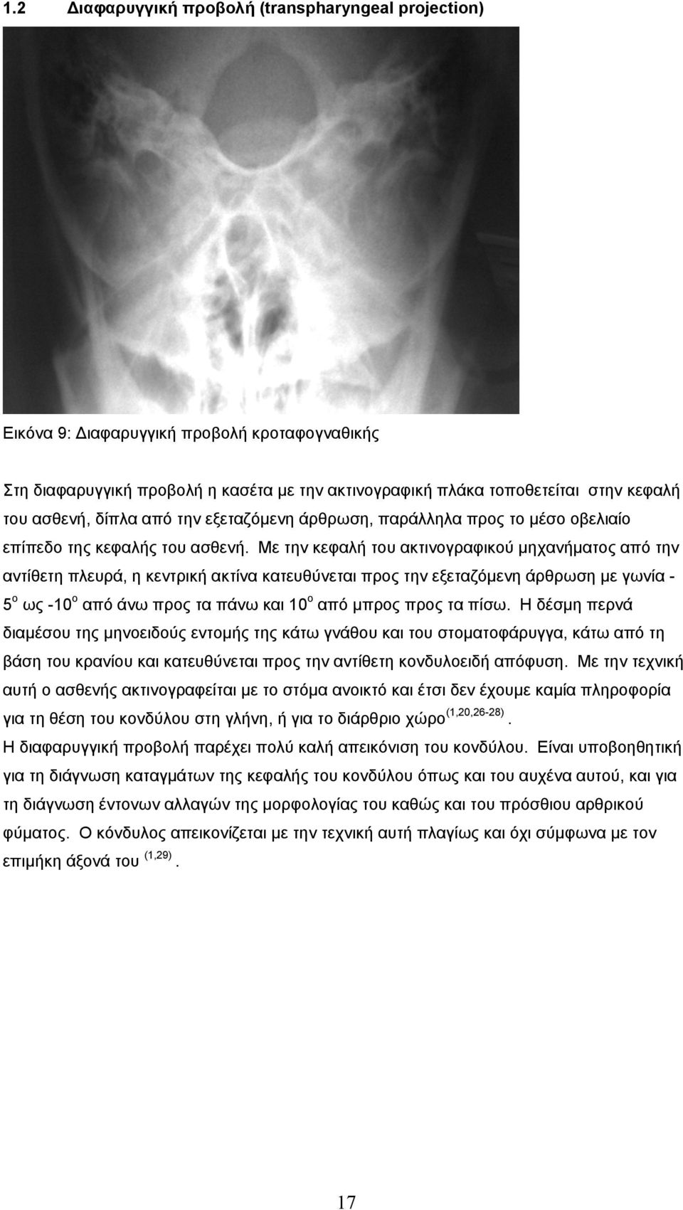 Με την κεφαλή του ακτινογραφικού µηχανήµατος από την αντίθετη πλευρά, η κεντρική ακτίνα κατευθύνεται προς την εξεταζόµενη άρθρωση µε γωνία - 5 ο ως -10 ο από άνω προς τα πάνω και 10 ο από µπρος προς