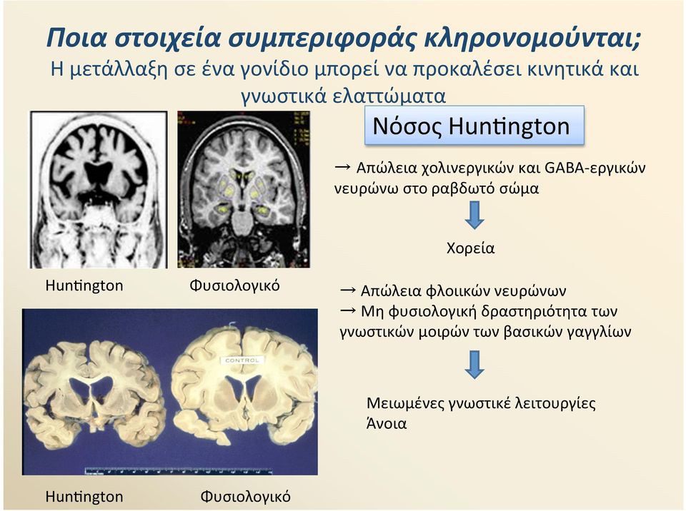 στο ραβδωτό σώμα Χορεία Huncngton Φυσιολογικό Απώλεια φλοιικών νευρώνων Μη φυσιολογική