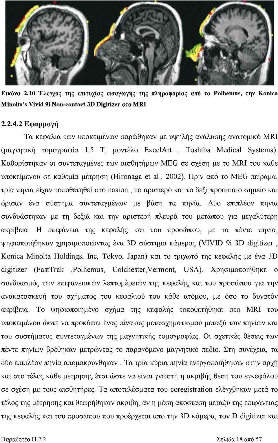 Καθορίστηκαν οι συντεταγμένες των αισθητήρων MEG σε σχέση με το MRI του κάθε υποκείμενου σε καθεμία μέτρηση (Hironaga et al., 2002).