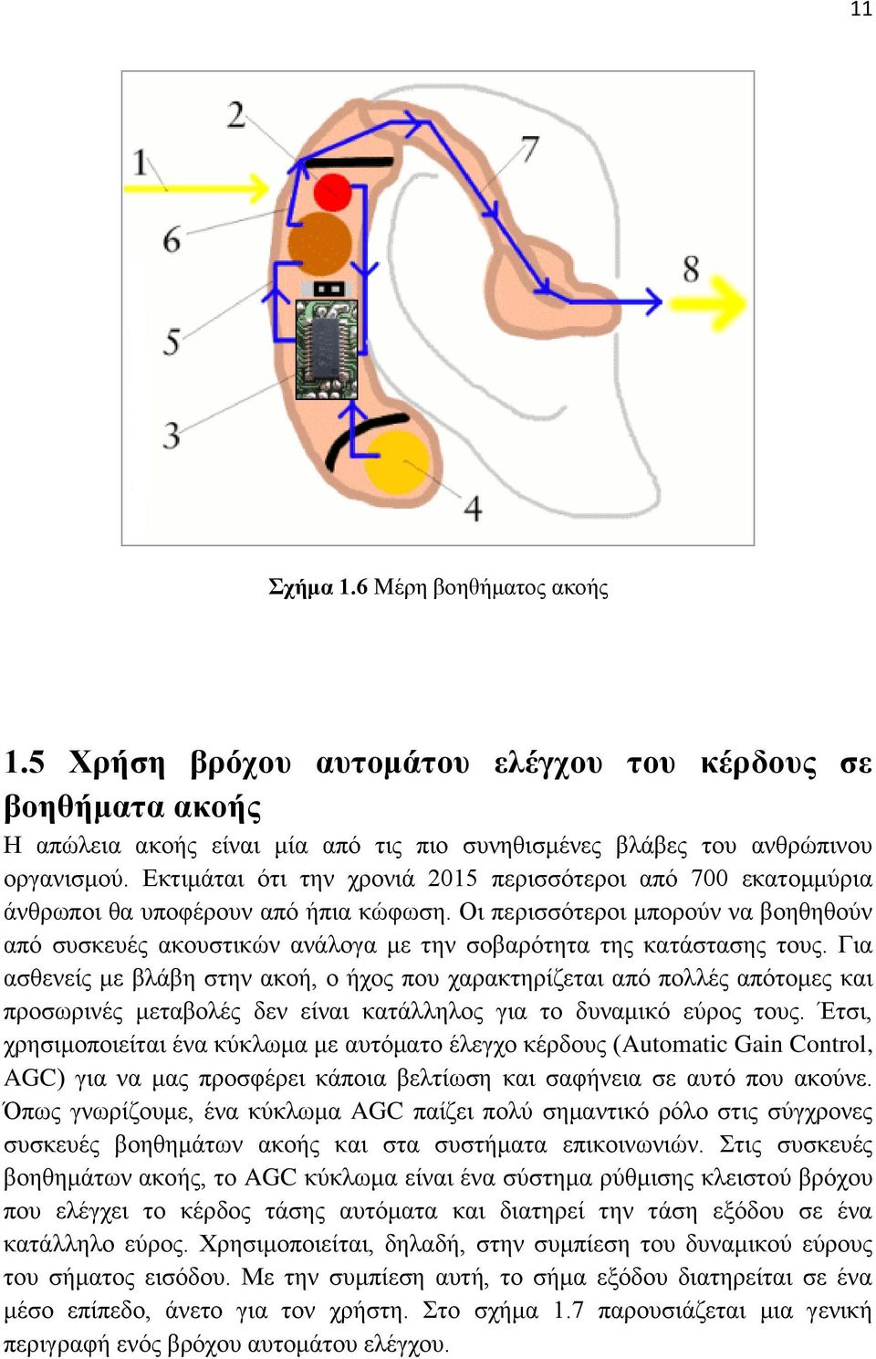 Οι περισσότεροι μπορούν να βοηθηθούν από συσκευές ακουστικών ανάλογα με την σοβαρότητα της κατάστασης τους.