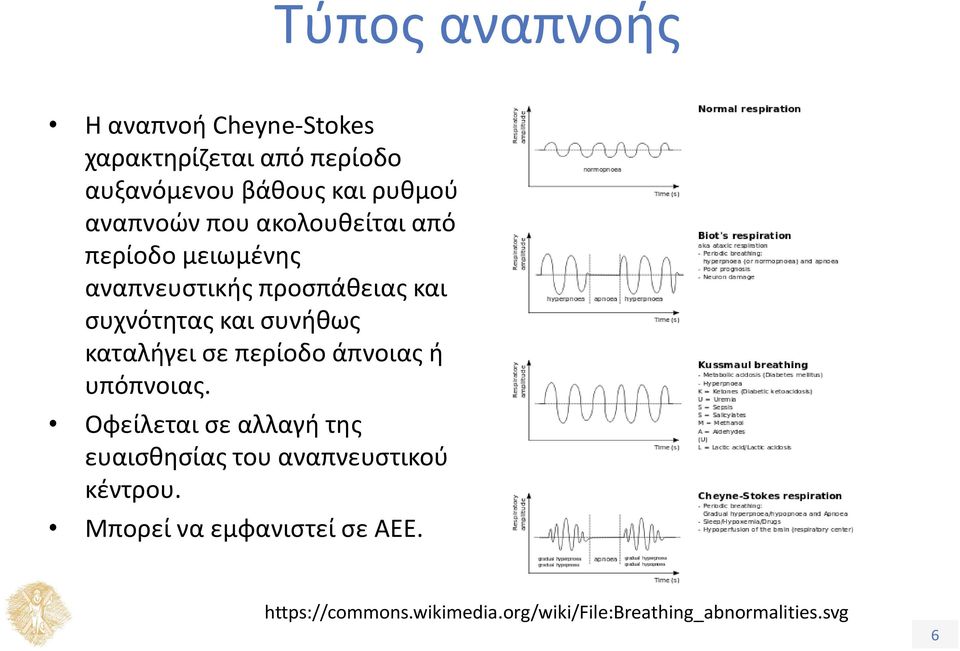 συνήθως καταλήγει σε περίοδο άπνοιας ή υπόπνοιας.