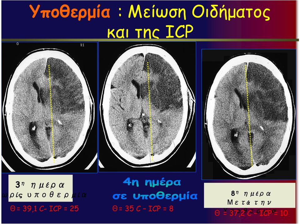 39,1 C- ICP = 25 Θ= 35 C ICP = 8 8η