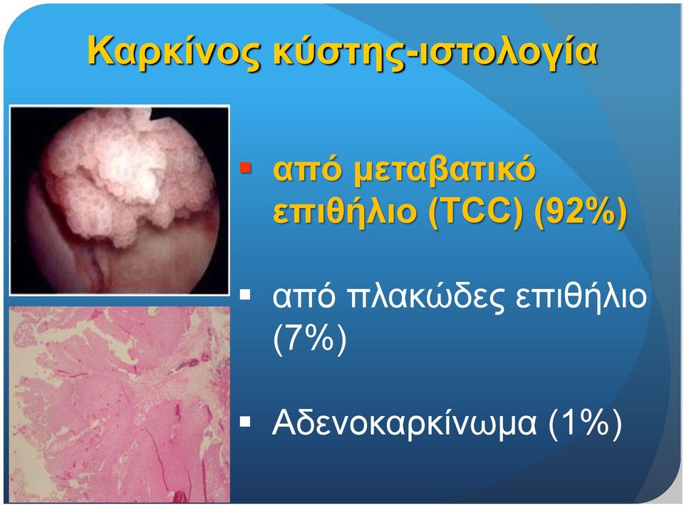 (TCC) (92%) από πλακώδες