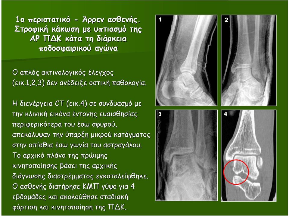 1,2,3) δεν ανέδειξε οστική παθολογία. Η διενέργεια CT (εικ.