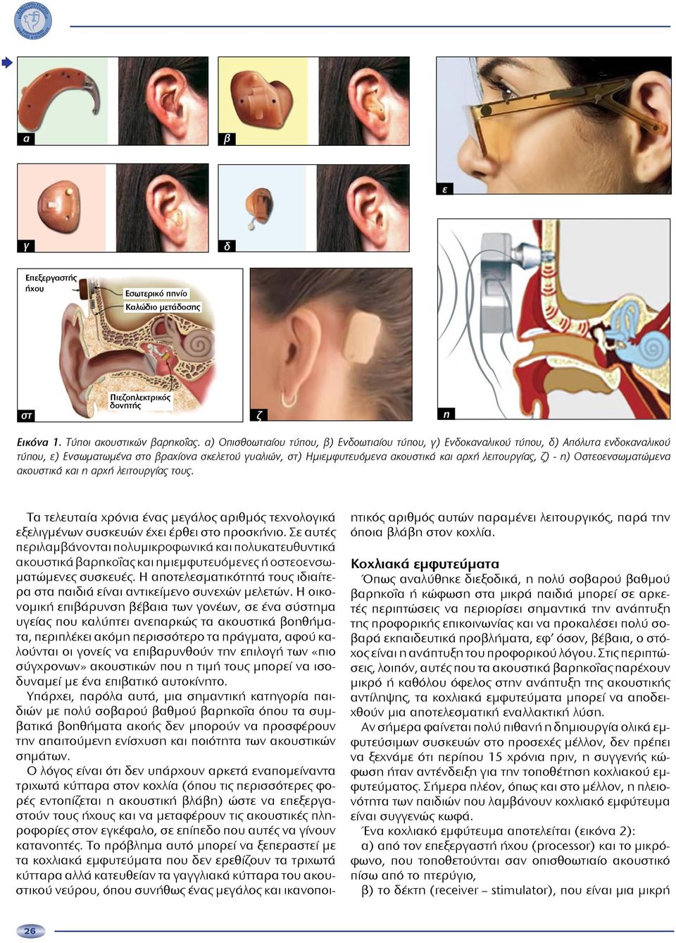 λειτουργίας, ζ) - η) Οστεοενσωματώμενα ακουστικά και η αρχή λειτουργίας τους. Τα τελευταία χρόνια ένας μεγάλος αριθμός τεχνολογικά εξελιγμένων συσκευών έχει έρθει στο προσκήνιο.
