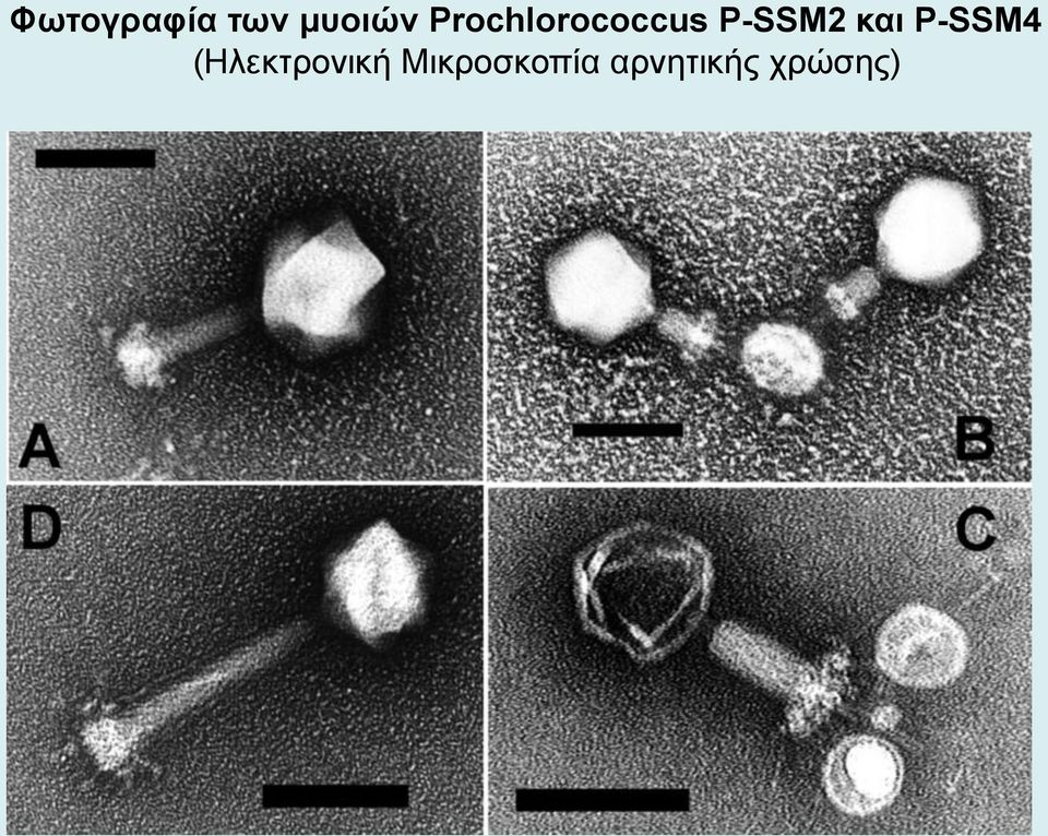 και P-SSM4 (Ηλεκτρονική