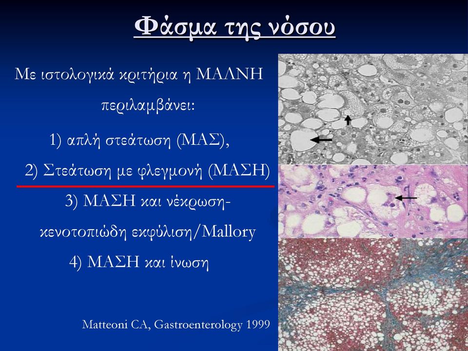 φλεγμονή (ΜΑΗ) 3) ΜΑΗ και νέκρωσηκενοτοπιώδη