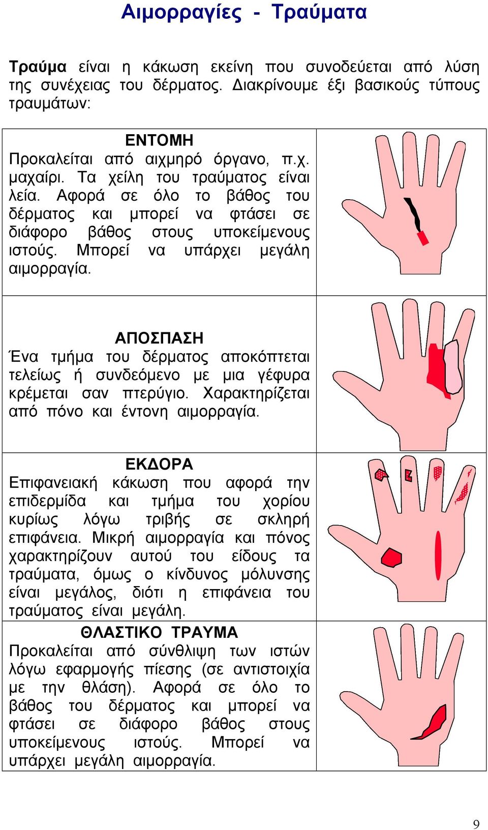 ΑΠΟΣΠΑΣΗ Ένα τµήµα του δέρµατος αποκόπτεται τελείως ή συνδεόµενο µε µια γέφυρα κρέµεται σαν πτερύγιο. Χαρακτηρίζεται από πόνο και έντονη αιµορραγία.