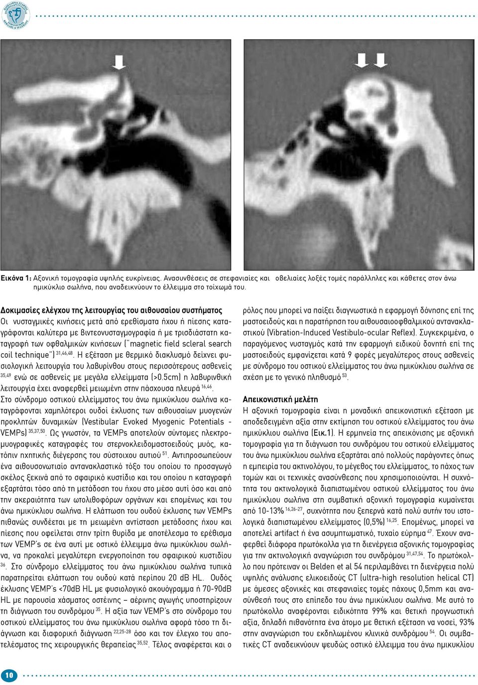 οφθαλμικών κινήσεων ( magnetic field scleral search coil technique ) 31,46,48.