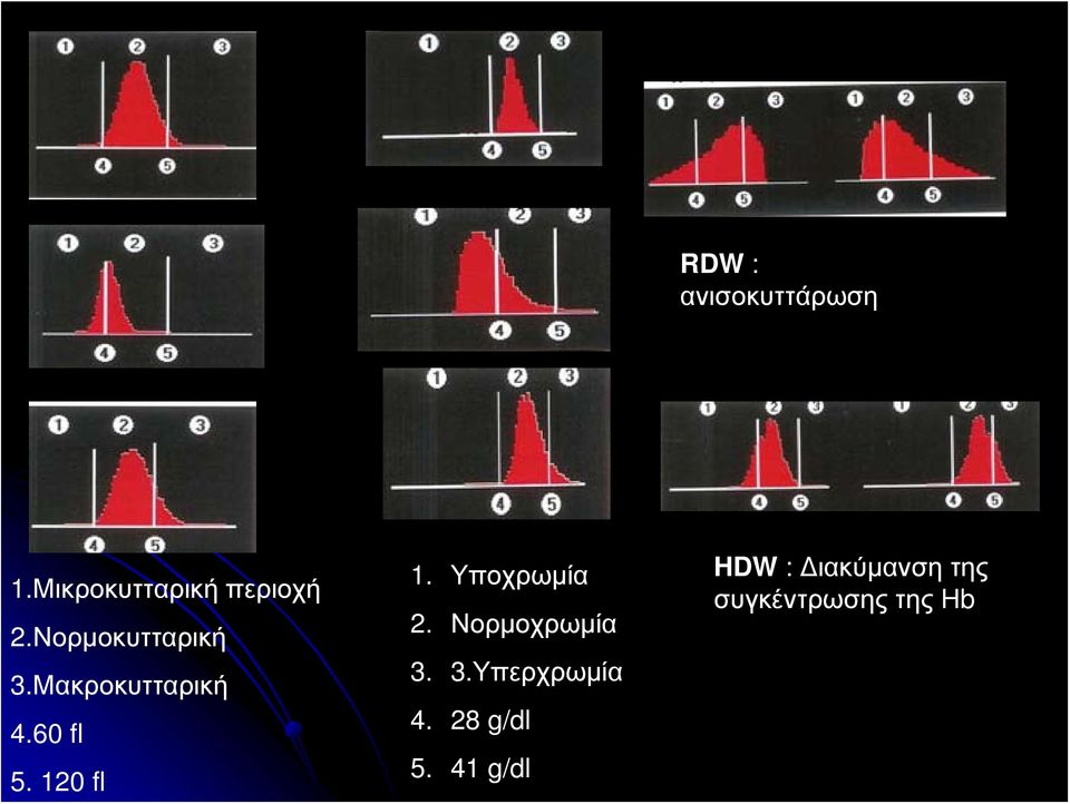 120 fl 1. Υποχρωμία 2. Νορμοχρωμία 3. 3.Υπερχρωμία 4.