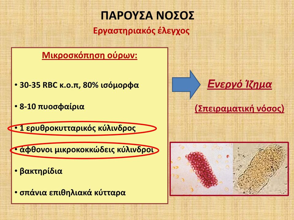 π, 80% ισόμορφα 8-10 πυοσφαίρια Ενεργό Ίζημα (Σπειραματική