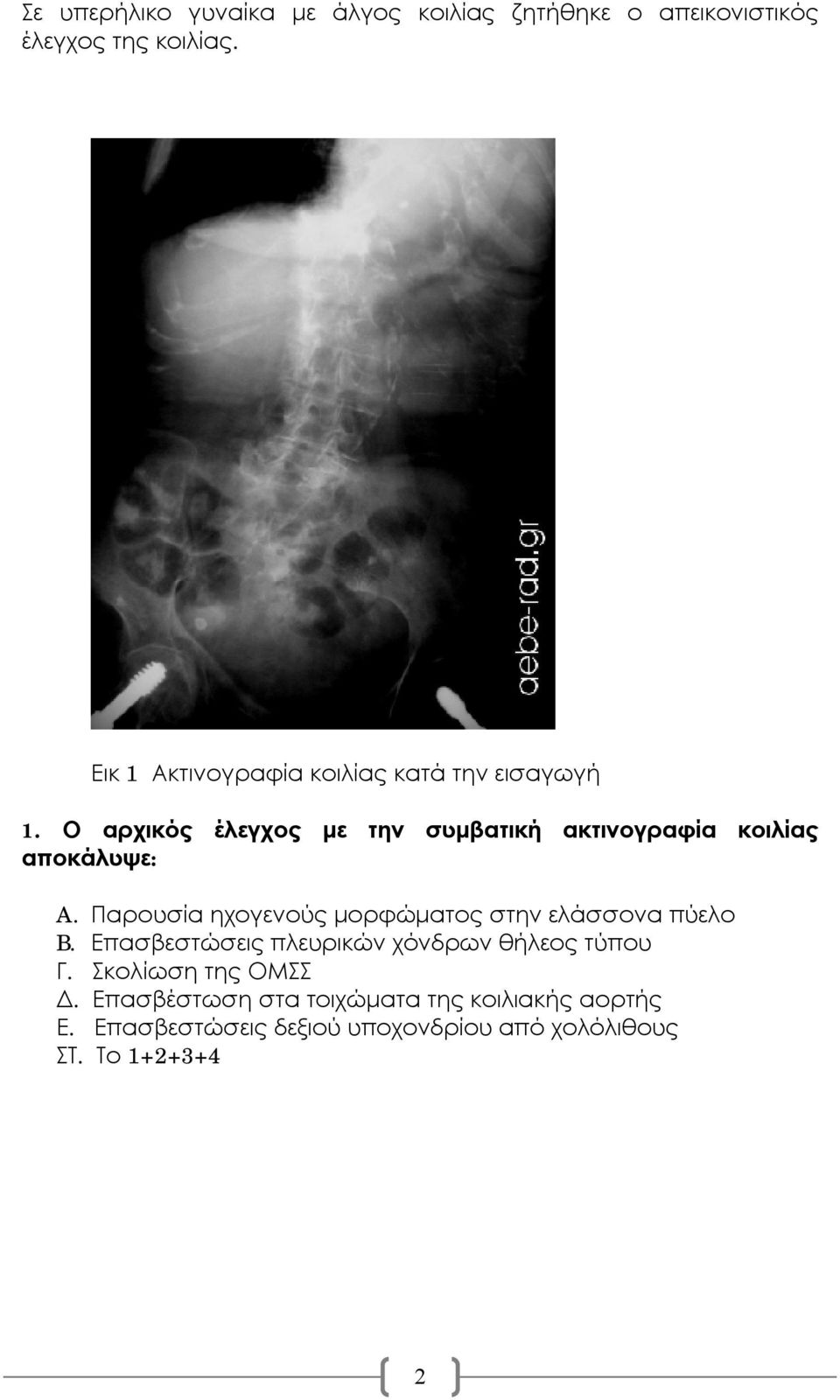 Ο αρχικός έλεγχος με την συμβατική ακτινογραφία κοιλίας αποκάλυψε: A.