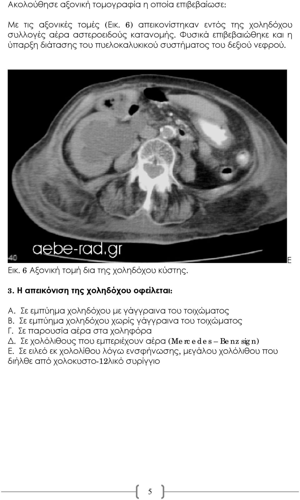 Η απεικόνιση της χοληδόχου οφείλεται: Α. Σε εμπύημα χοληδόχου με γάγγραινα του τοιχώματος Β. Σε εμπύημα χοληδόχου χωρίς γάγγραινα του τοιχώματος Γ.